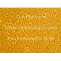 SHR Rat Endothelial Cells